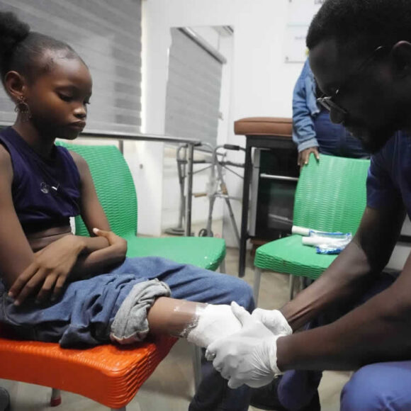 Artificial Limbs, Renewed Lives: Over 500 Prosthetics Delivered