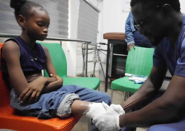 Artificial Limbs, Renewed Lives: Over 500 Prosthetics Delivered